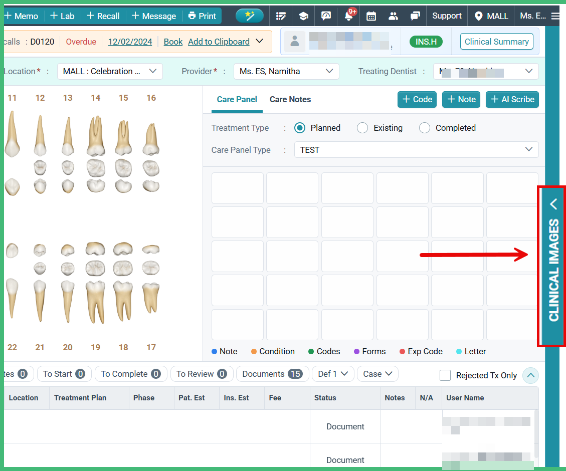 Change Tooth Number in TigerView – CareStack: User Resource Center