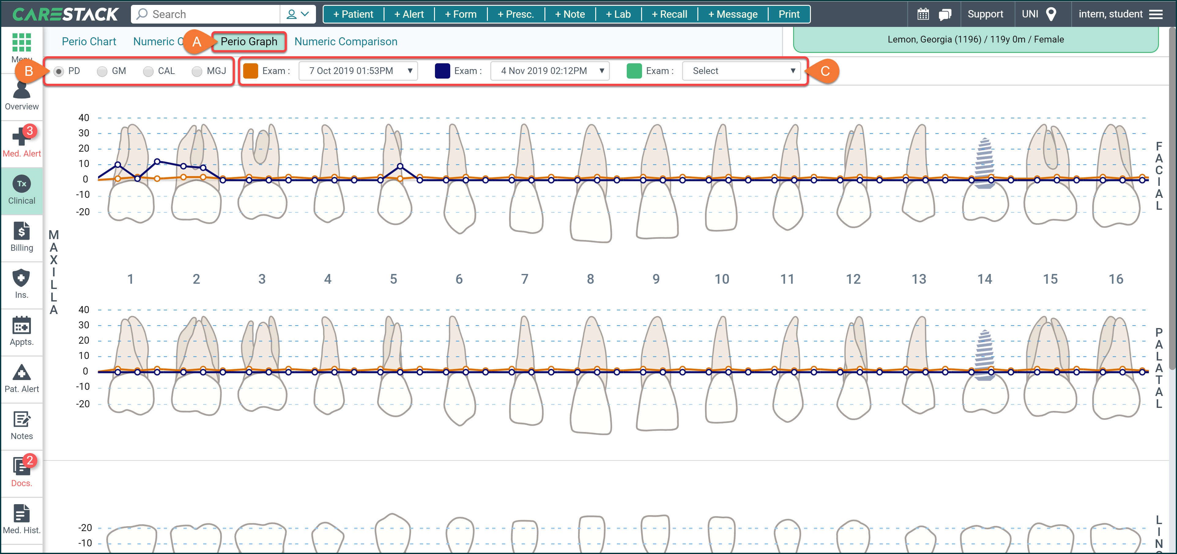 Printable Perio Graph Chart