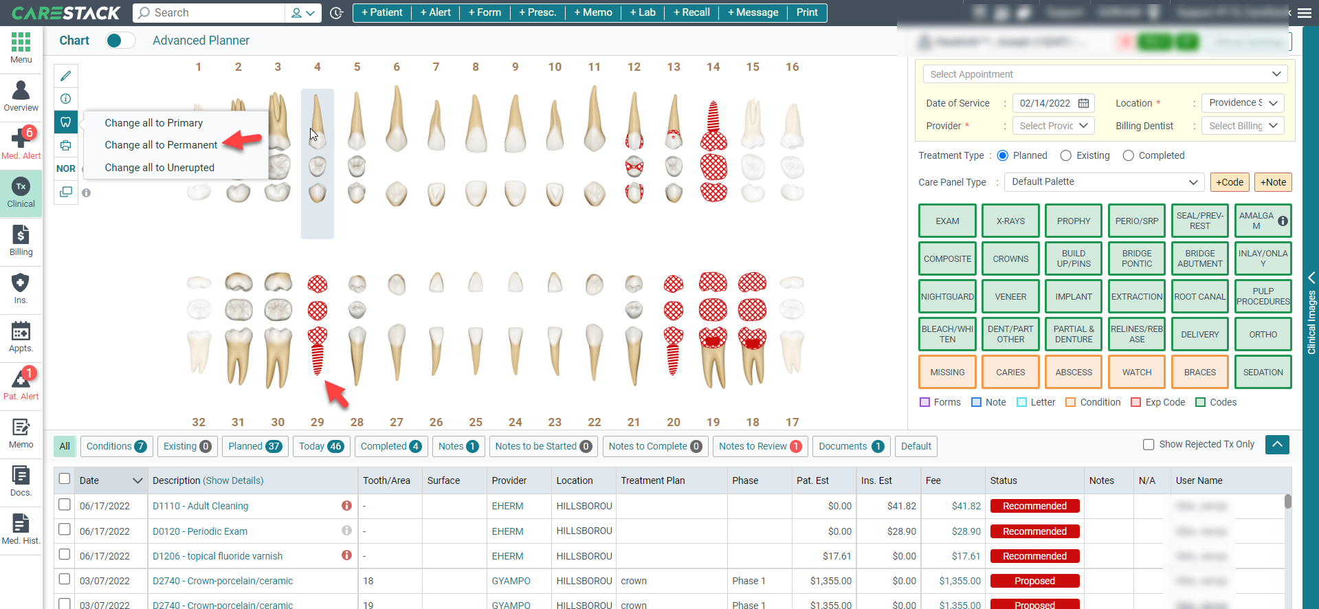 How to Chart the Same Tooth as Extraction and Implant – CareStack: User ...